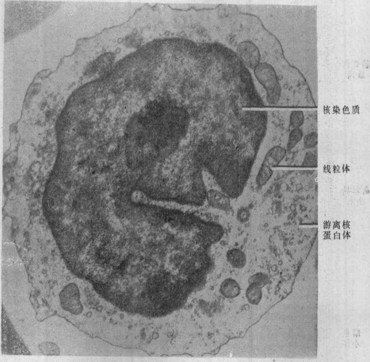 图1～10 间期细胞核(电镜照像)-功能组织学与胚胎学-医学